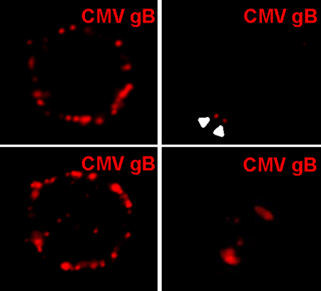 Immunocytochemistry/ Immunofluorescence - Anti-Cytomegalovirus Glycoprotein B antibody [HCMV37] (AB54023), expandable thumbnail