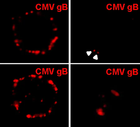 Immunocytochemistry/ Immunofluorescence - Anti-Cytomegalovirus Glycoprotein B antibody [HCMV37] (AB54023)