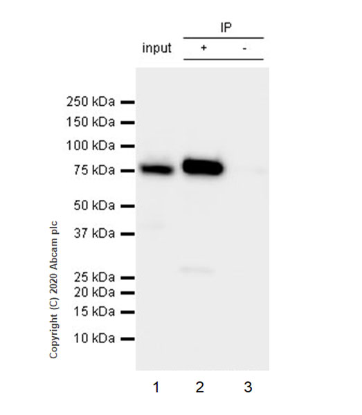 Immunoprecipitation - Anti-Cytoplasmic Dynein Intermediate chain antibody [74.1] (AB23905), expandable thumbnail