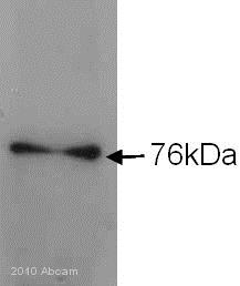 Western blot - Anti-Cytoplasmic Dynein Intermediate chain antibody [74.1] (AB23905), expandable thumbnail