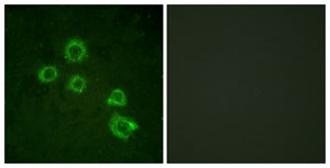 Immunocytochemistry/ Immunofluorescence - Anti-Cytosolic Phospholipase A2 antibody (AB139388)