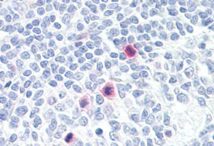 Immunohistochemistry (Formalin/PFA-fixed paraffin-embedded sections) - Anti-Cytosolic Phospholipase A2 antibody (AB139388)