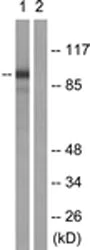 Western blot - Anti-Cytosolic Phospholipase A2 antibody (AB139388)