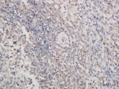 Immunohistochemistry (Formalin/PFA-fixed paraffin-embedded sections) - Anti-Cytosolic Phospholipase A2 antibody (AB58375)