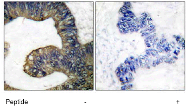 Immunohistochemistry (Formalin/PFA-fixed paraffin-embedded sections) - Anti-Cytosolic Phospholipase A2 antibody (AB58375)