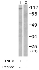 Western blot - Anti-Cytosolic Phospholipase A2 antibody (AB58375)