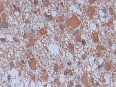 Immunohistochemistry (Formalin/PFA-fixed paraffin-embedded sections) - Anti-Cytosolic Phospholipase A2 antibody [C1] (AB239730)