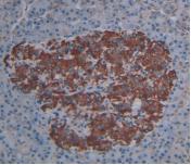 Immunohistochemistry (Formalin/PFA-fixed paraffin-embedded sections) - Anti-Cytosolic Phospholipase A2 antibody [C1] (AB239730)