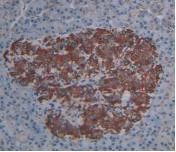 Immunohistochemistry (Formalin/PFA-fixed paraffin-embedded sections) - Anti-Cytosolic Phospholipase A2 antibody [C1] (AB239730)
