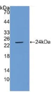 Western blot - Anti-Cytosolic Phospholipase A2 antibody [C1] (AB239730)