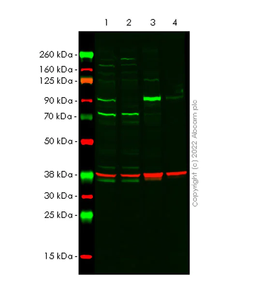 Western blot - Anti-Cytosolic Phospholipase A2 antibody [EPR26068-26] (AB307889)