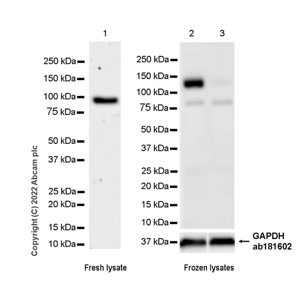 Western blot - Anti-Cytosolic Phospholipase A2 antibody [EPR26068-26] (AB307889)