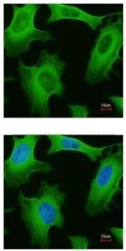 Immunocytochemistry/ Immunofluorescence - Anti-Cytosolic Phospholipase A2 antibody - N-terminal (AB227246)
