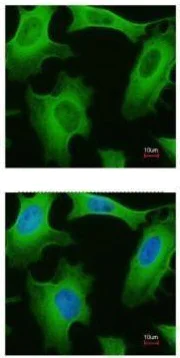 Immunocytochemistry/ Immunofluorescence - Anti-Cytosolic Phospholipase A2 antibody - N-terminal (AB227246)