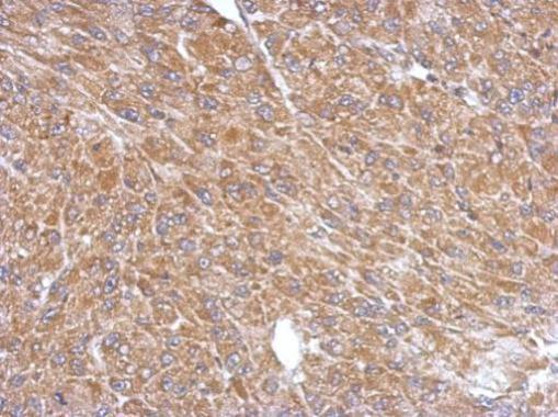 Immunohistochemistry (Formalin/PFA-fixed paraffin-embedded sections) - Anti-Cytosolic Phospholipase A2 antibody - N-terminal (AB227246)