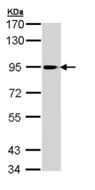 Western blot - Anti-Cytosolic Phospholipase A2 antibody - N-terminal (AB227246)