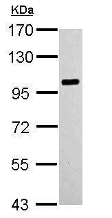 Western blot - Anti-Cytosolic Phospholipase A2 antibody - N-terminal (AB227246)