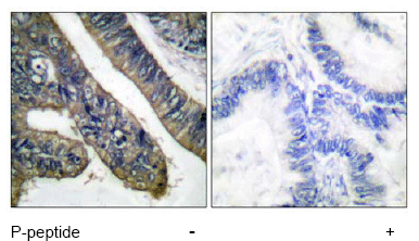 Immunohistochemistry (Formalin/PFA-fixed paraffin-embedded sections) - Anti-Cytosolic Phospholipase A2 (phospho S505) antibody (AB53105)