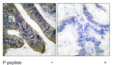 Immunohistochemistry (Formalin/PFA-fixed paraffin-embedded sections) - Anti-Cytosolic Phospholipase A2 (phospho S505) antibody (AB53105)