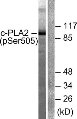 Western blot - Anti-Cytosolic Phospholipase A2 (phospho S505) antibody (AB53105)