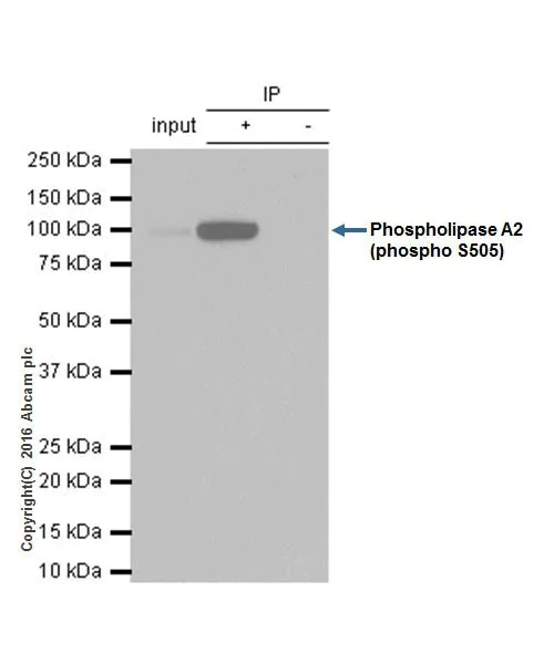 Immunoprecipitation - Anti-Cytosolic Phospholipase A2 (phospho S505) antibody [EPR18552] (AB191605)
