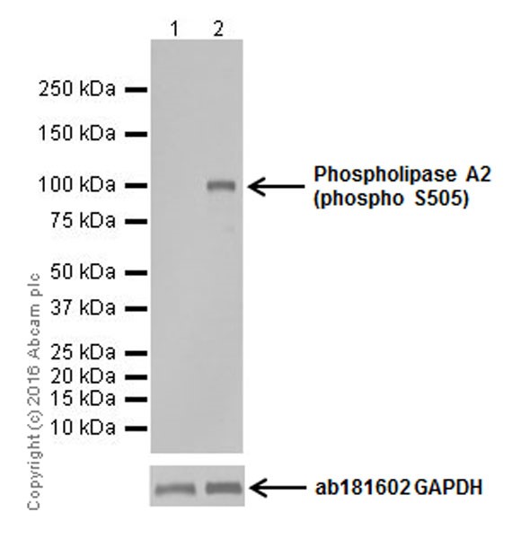 Western blot - Anti-Cytosolic Phospholipase A2 (phospho S505) antibody [EPR18552] (AB191605)