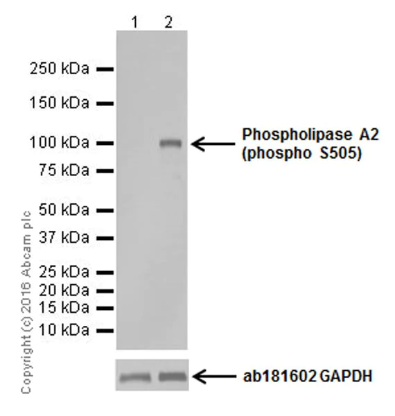 Western blot - Anti-Cytosolic Phospholipase A2 (phospho S505) antibody [EPR18552] - BSA and Azide free (AB251094)