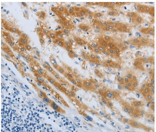 Immunohistochemistry (Formalin/PFA-fixed paraffin-embedded sections) - Anti-D-10 antibody (AB198719)