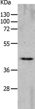 Western blot - Anti-D-10 antibody (AB198719)