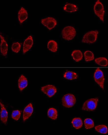 Immunocytochemistry/ Immunofluorescence - Anti-D Amino Acid Oxidase antibody (AB187525)