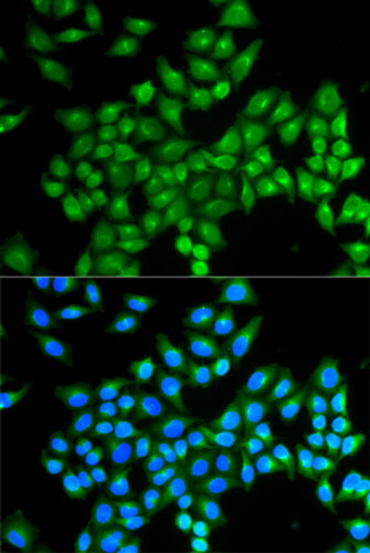 Immunocytochemistry/ Immunofluorescence - Anti-D Amino Acid Oxidase antibody (AB196563)
