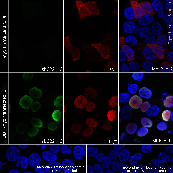 Immunocytochemistry/ Immunofluorescence - Anti-D Box Binding Protein antibody [EPR22370-51] (AB222112)