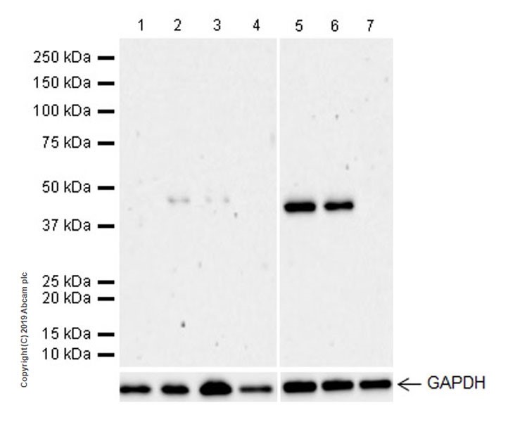 Western blot - Anti-D Box Binding Protein antibody [EPR22370-51] (AB222112), expandable thumbnail