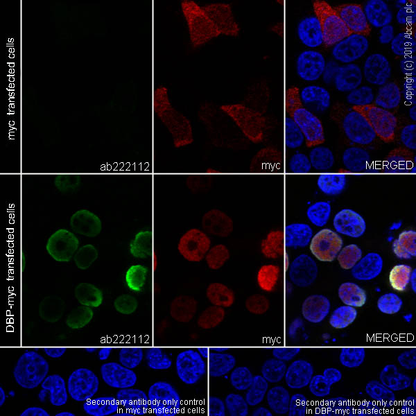 Immunocytochemistry/ Immunofluorescence - Anti-D Box Binding Protein antibody [EPR22370-51] - BSA and Azide free (AB263022), expandable thumbnail
