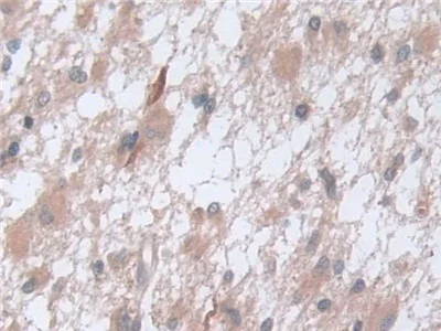 Immunohistochemistry (Formalin/PFA-fixed paraffin-embedded sections) - Anti-D2HGDH antibody (AB233516)