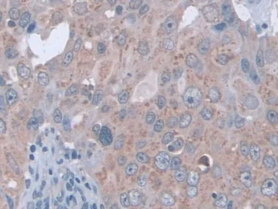 Immunohistochemistry (Formalin/PFA-fixed paraffin-embedded sections) - Anti-D2HGDH antibody (AB233516)
