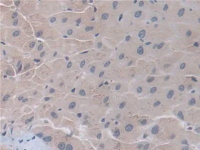 Immunohistochemistry (Formalin/PFA-fixed paraffin-embedded sections) - Anti-D2HGDH antibody (AB233516)