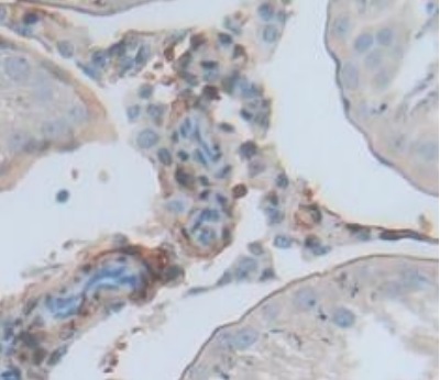 Immunohistochemistry (Formalin/PFA-fixed paraffin-embedded sections) - Anti-D2HGDH antibody (AB233516)
