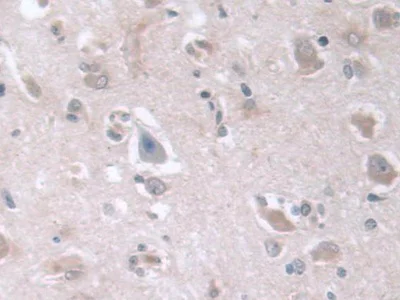 Immunohistochemistry (Formalin/PFA-fixed paraffin-embedded sections) - Anti-D2HGDH antibody (AB233516)