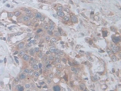 Immunohistochemistry (Formalin/PFA-fixed paraffin-embedded sections) - Anti-D2HGDH antibody (AB233516)