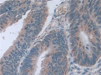 Immunohistochemistry (Formalin/PFA-fixed paraffin-embedded sections) - Anti-D2HGDH antibody (AB233516)