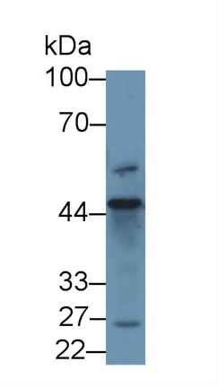 Western blot - Anti-D2HGDH antibody (AB233516)