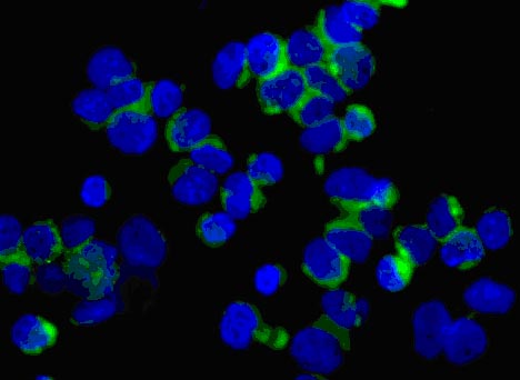 Immunocytochemistry/ Immunofluorescence - Anti-D4 GDI antibody [EPR14211(B)] (AB181259), expandable thumbnail