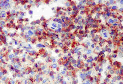 Immunohistochemistry (Formalin/PFA-fixed paraffin-embedded sections) - Anti-D4 GDI antibody [EPR14211(B)] (AB181259), expandable thumbnail