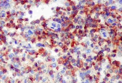 Immunohistochemistry (Formalin/PFA-fixed paraffin-embedded sections) - Anti-D4 GDI antibody [EPR14211(B)] (AB181259)