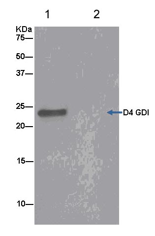 Immunoprecipitation - Anti-D4 GDI antibody [EPR14211(B)] (AB181259), expandable thumbnail