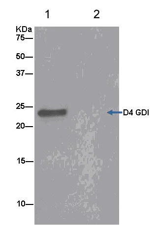Immunoprecipitation - Anti-D4 GDI antibody [EPR14211(B)] (AB181259)