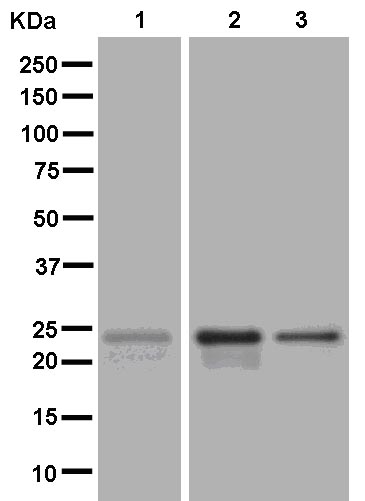 Western blot - Anti-D4 GDI antibody [EPR14211(B)] (AB181259), expandable thumbnail
