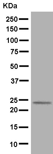 Western blot - Anti-D4 GDI antibody [EPR14211(B)] (AB181259), expandable thumbnail