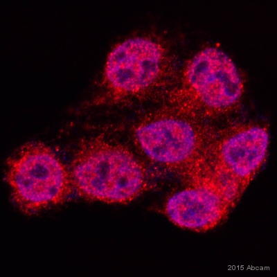 Immunocytochemistry/ Immunofluorescence - Anti-D4 GDI antibody [EPR14212(B)] (AB181252)